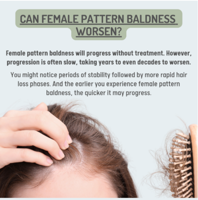 Can female pattern baldness worsen?