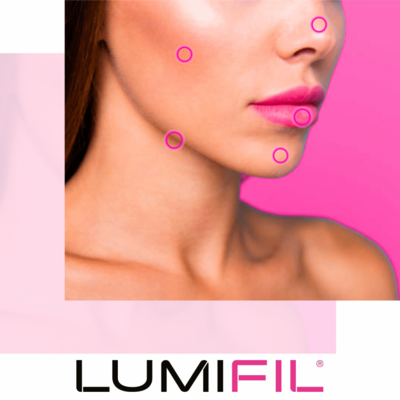 LUMIFIL L-KISS with lidocaine - CE MARKED