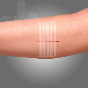 Wound Closure Strips 3mm * 75 mm * 5 strips pre card Wound Closure Strips 3mm * 75 mm * 5 strips pre card