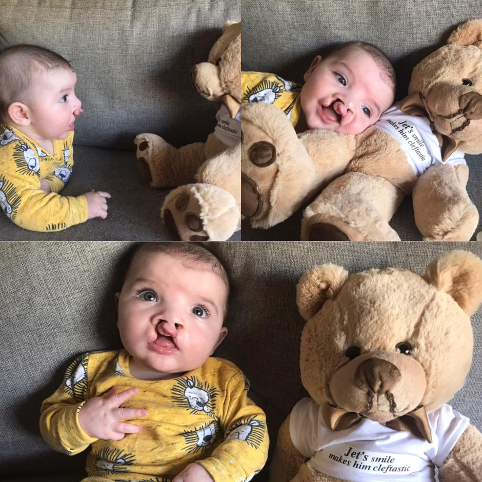 Lip Repair Hospital Support bag