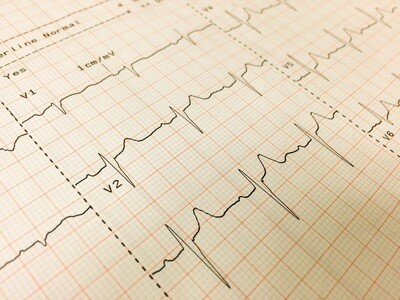 ECG/Ekg Chart Papers * Request quote