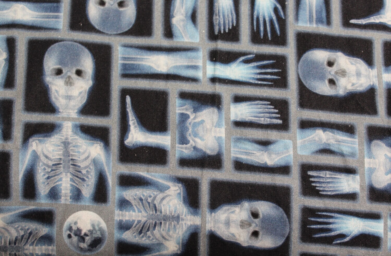 X-Ray!