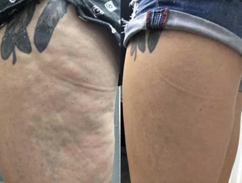 Firming/Cellulite Lotion