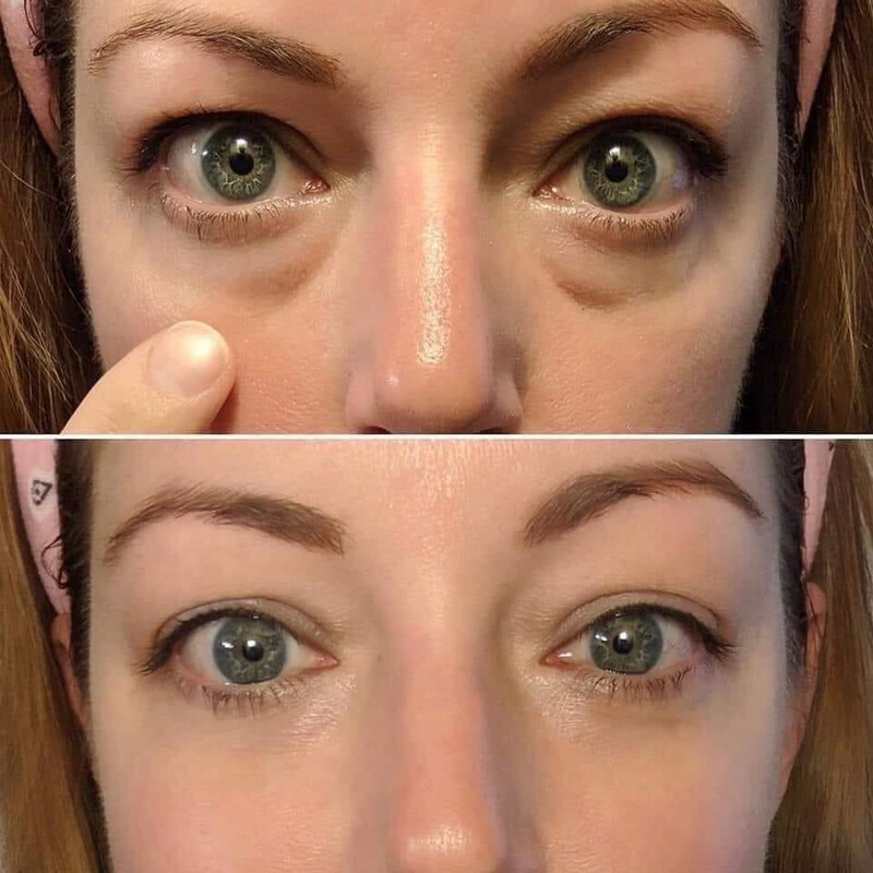 Ideal Eyes aka Puffy Eye Cream