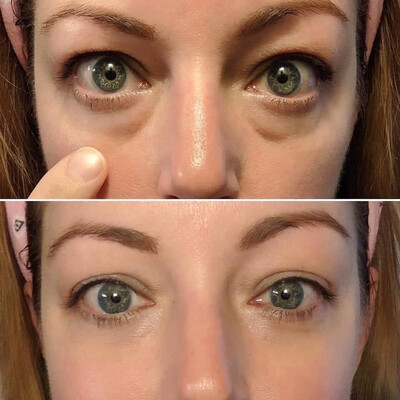 Ideal Eyes aka Puffy Eye Cream