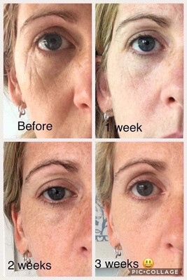 Tru Face Line Corrector