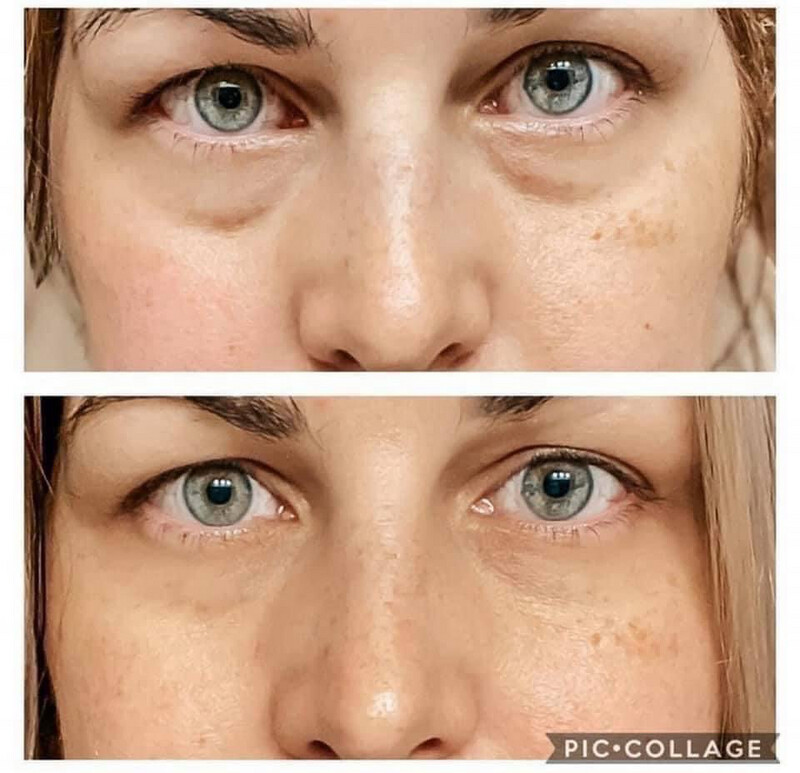 Lumispa Eye Accent with Ideal Eyes Cream