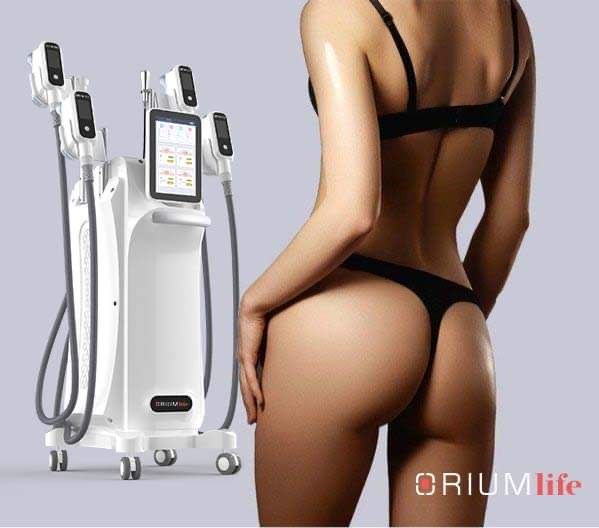 Cryolipolyse 1 beurt 4 koppen (bv buik, lovehandles en billen)