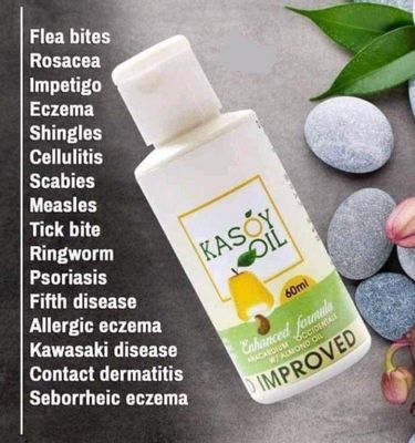 Kasoy Oil 60ml