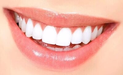 Teeth Whitening