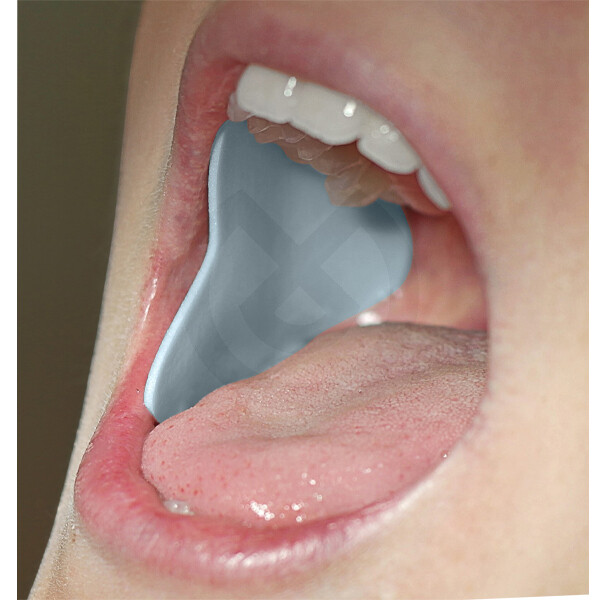 AISLANTE SALIVA DRYDENT PARÓTIDA PEQUEÑO
DIRECTA