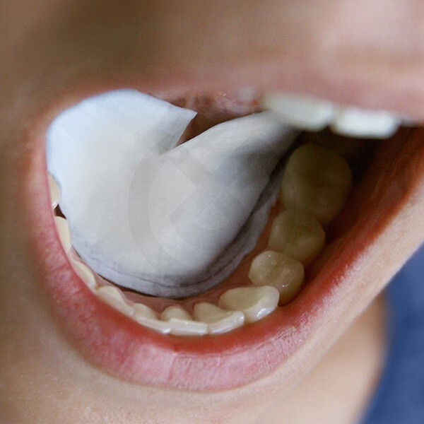 AISLANTE SALIVA DRYDENT SUBLINGUAL PEQUEÑO
DIRECTA