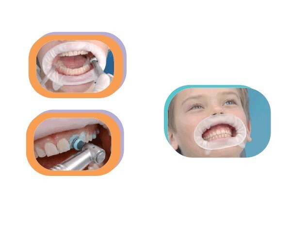 OPTRAGATE  80 UDS.
IVOCLAR