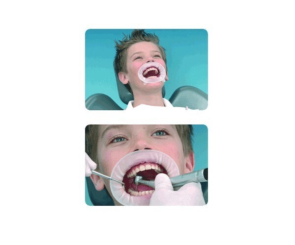 OPTRAGATE JUNIOR
IVOCLAR