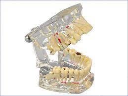 MODELO DE ESTUDIO TRANSPARENTE DELUXE
HAGER & WERKEN