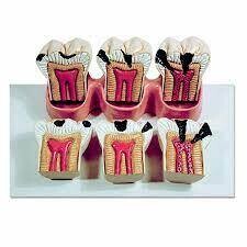 MODELO ESTADOS DE LA CARIES
DENTALSTORE