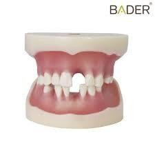 Tipodonto para implantología con articulador BADER® DENTAL
