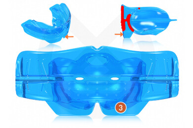 K3 MYOBRACE FOR KIDS
MYOFUNCTIONAL