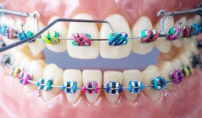 Orthodontics