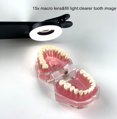 Macro Lens with ring LED