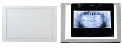 X-ray Viewer