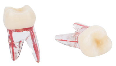 Endodontic Teeth