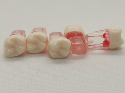 Endodontic Teeth