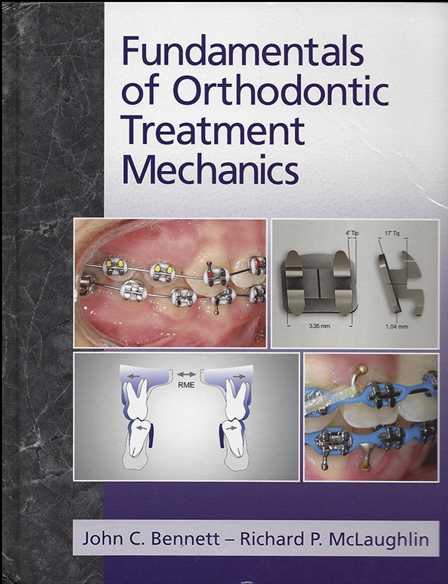 Fundamentals of orthodontic treatment mechanics