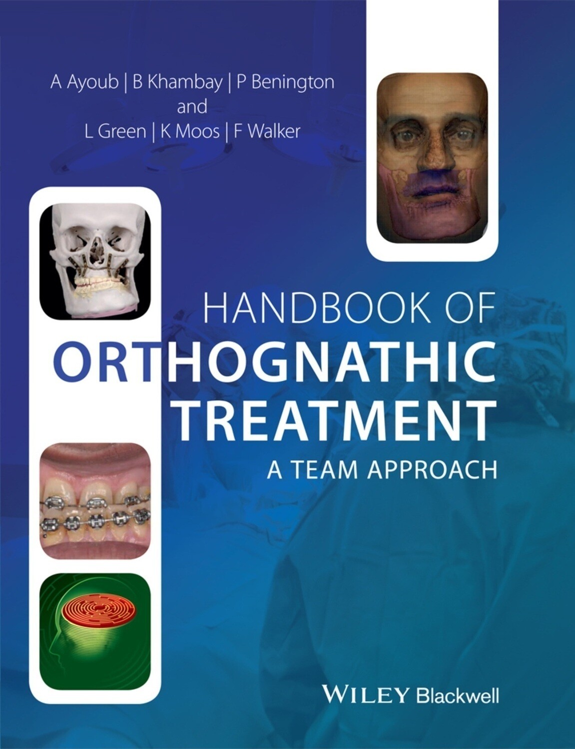 Handbook of Orthognathic Treatment