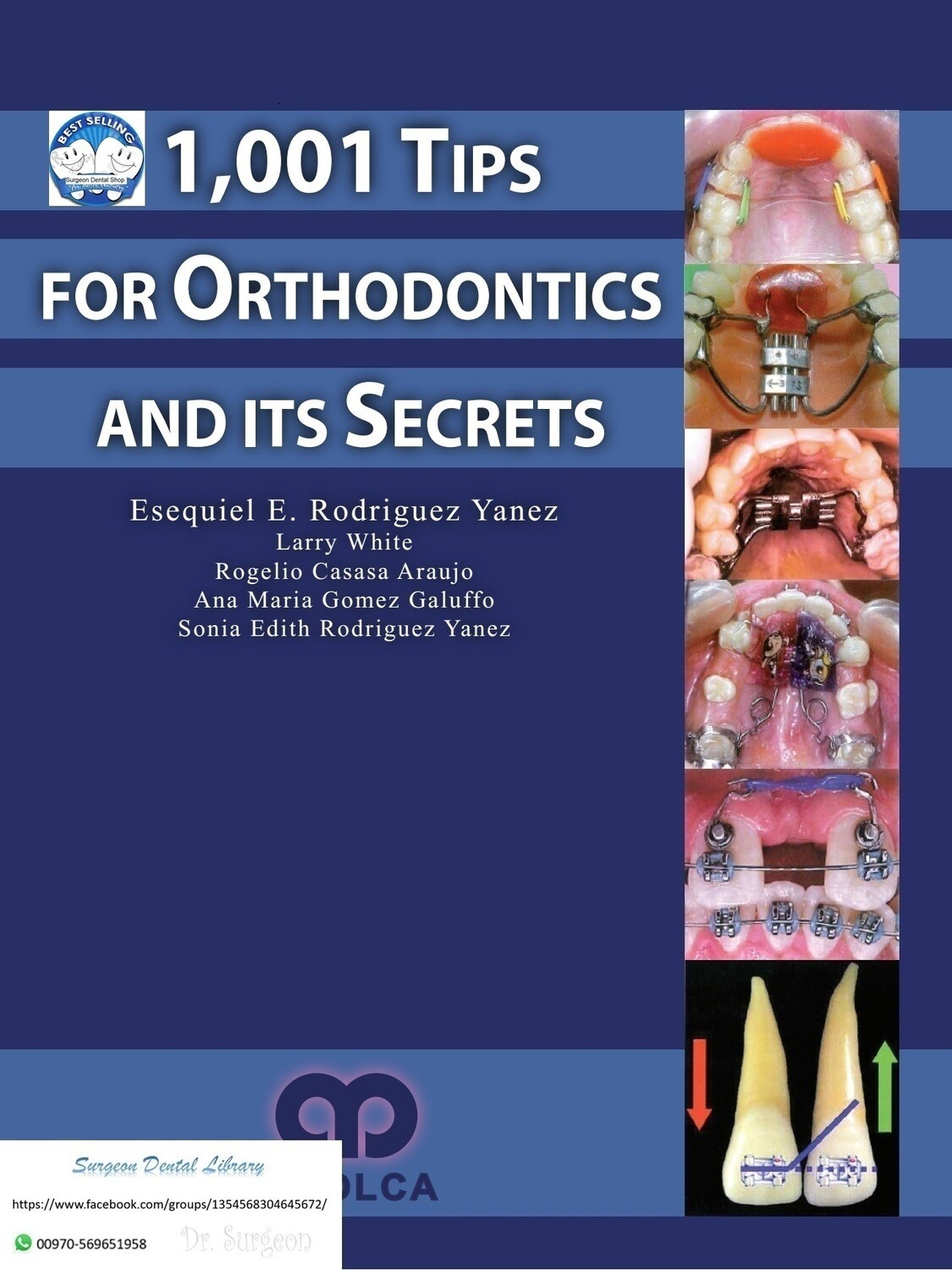 1001 Tips  for orthodontics &amp; its secrets