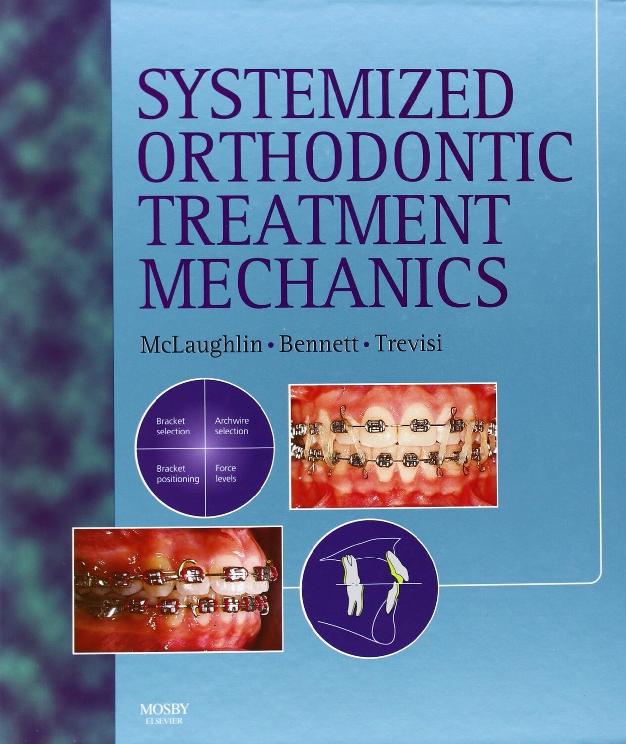 Systemized orthodontics treatment mechanics