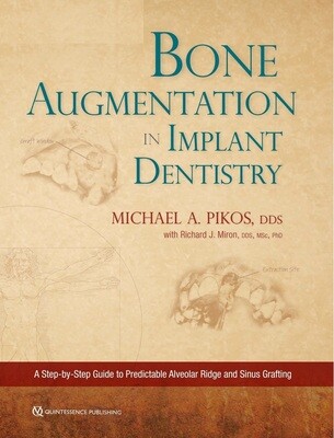 Bone augmentation in implant dentistry