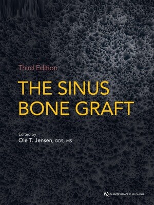 The Sinus Bone Graft