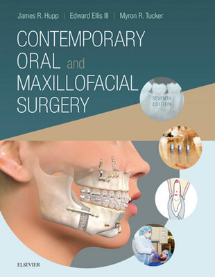 Oral and Maxillofacial surgery