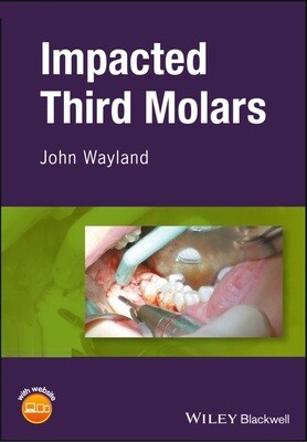 Impacted third molar