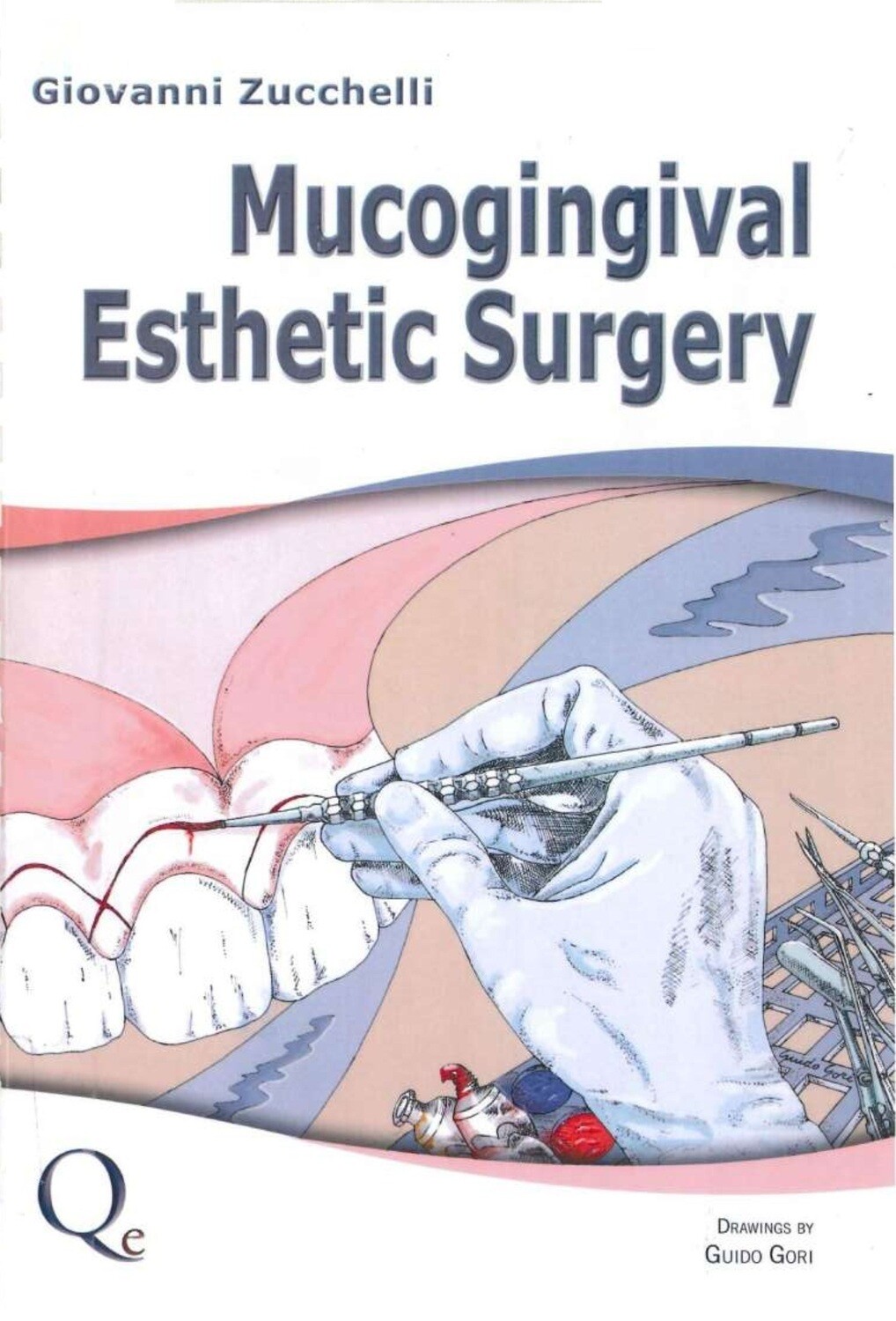 Mucogingival esthetic surgery