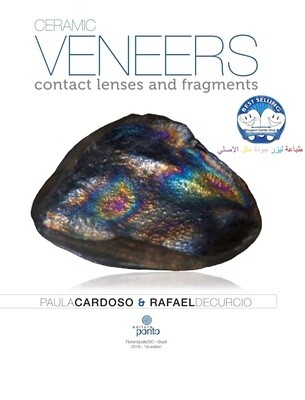 Ceramic Veneers Contact Lenses &amp; Fragments