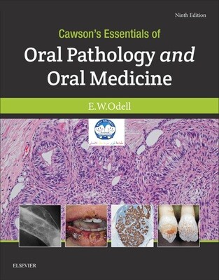 Oral Pathology