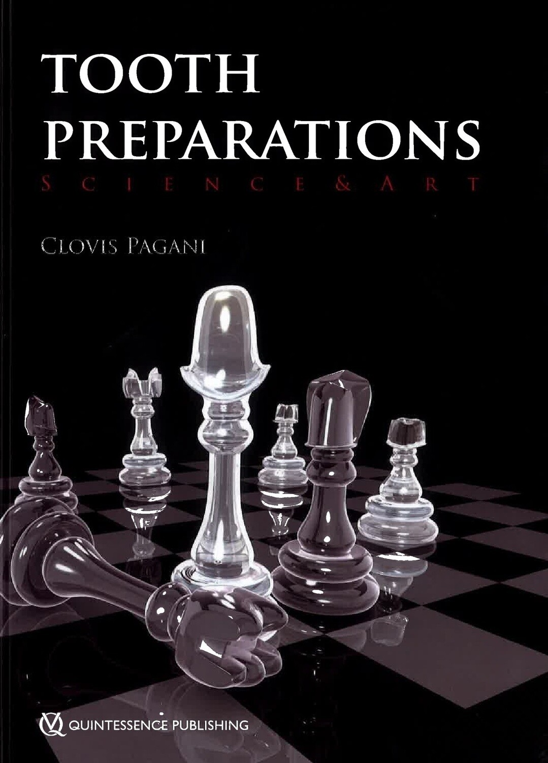 Tooth preparations science &amp; art