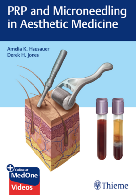 PRP and Microneedling in Aesthetic Medicine + Videos