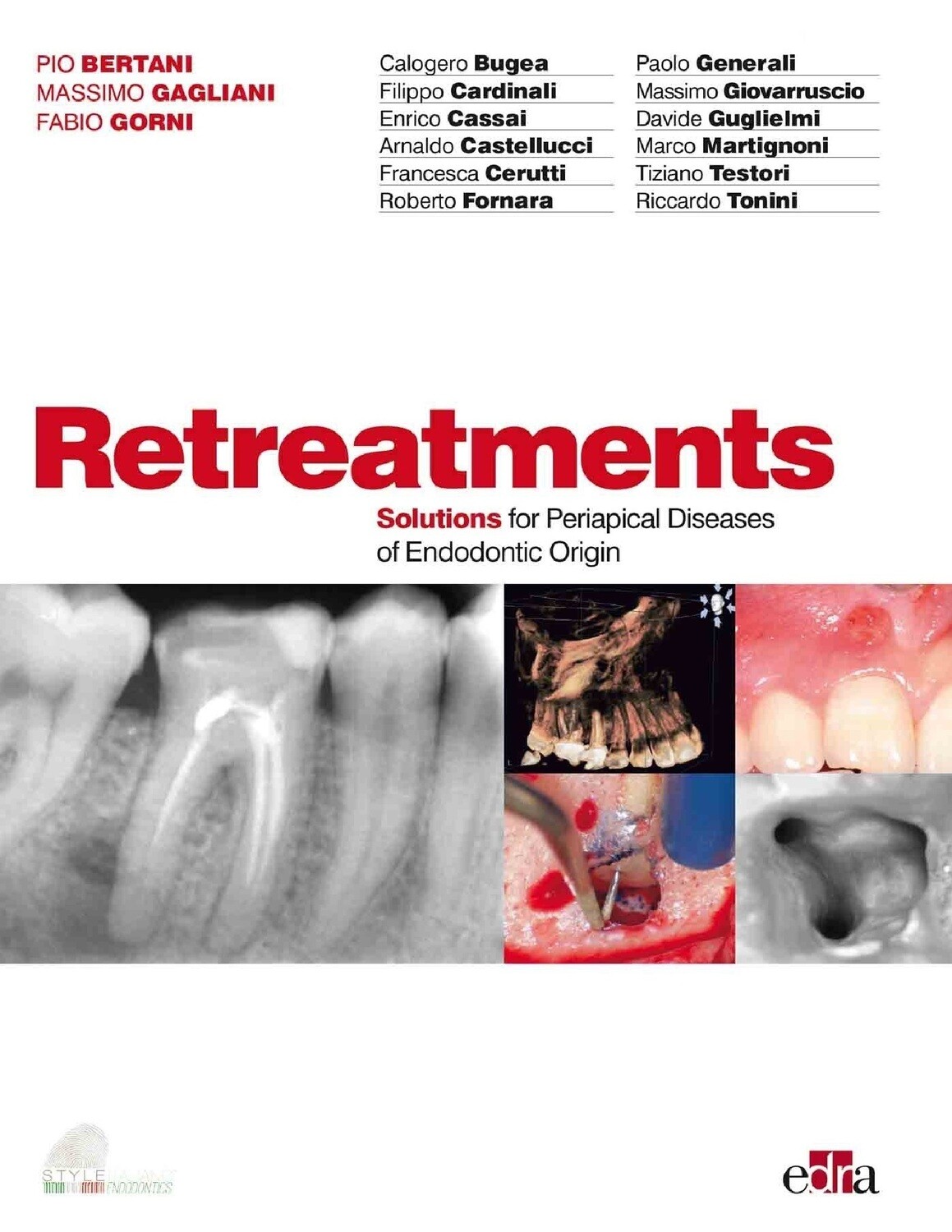 Retratments; solutions for periapical diseases of endodontic origin