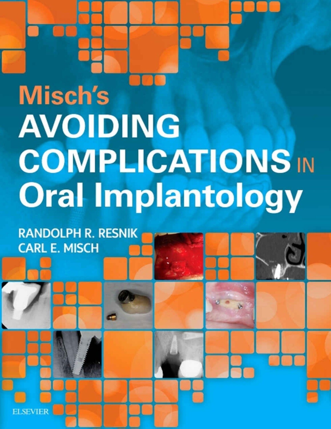 MisCh avoiding complications in implantology