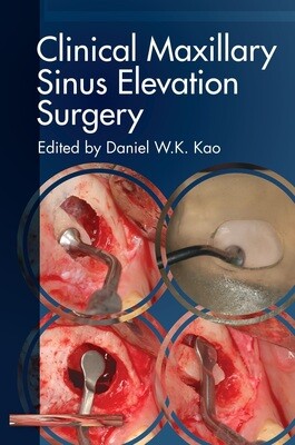 Clinical Maxillary Sinus Elevation Surgery