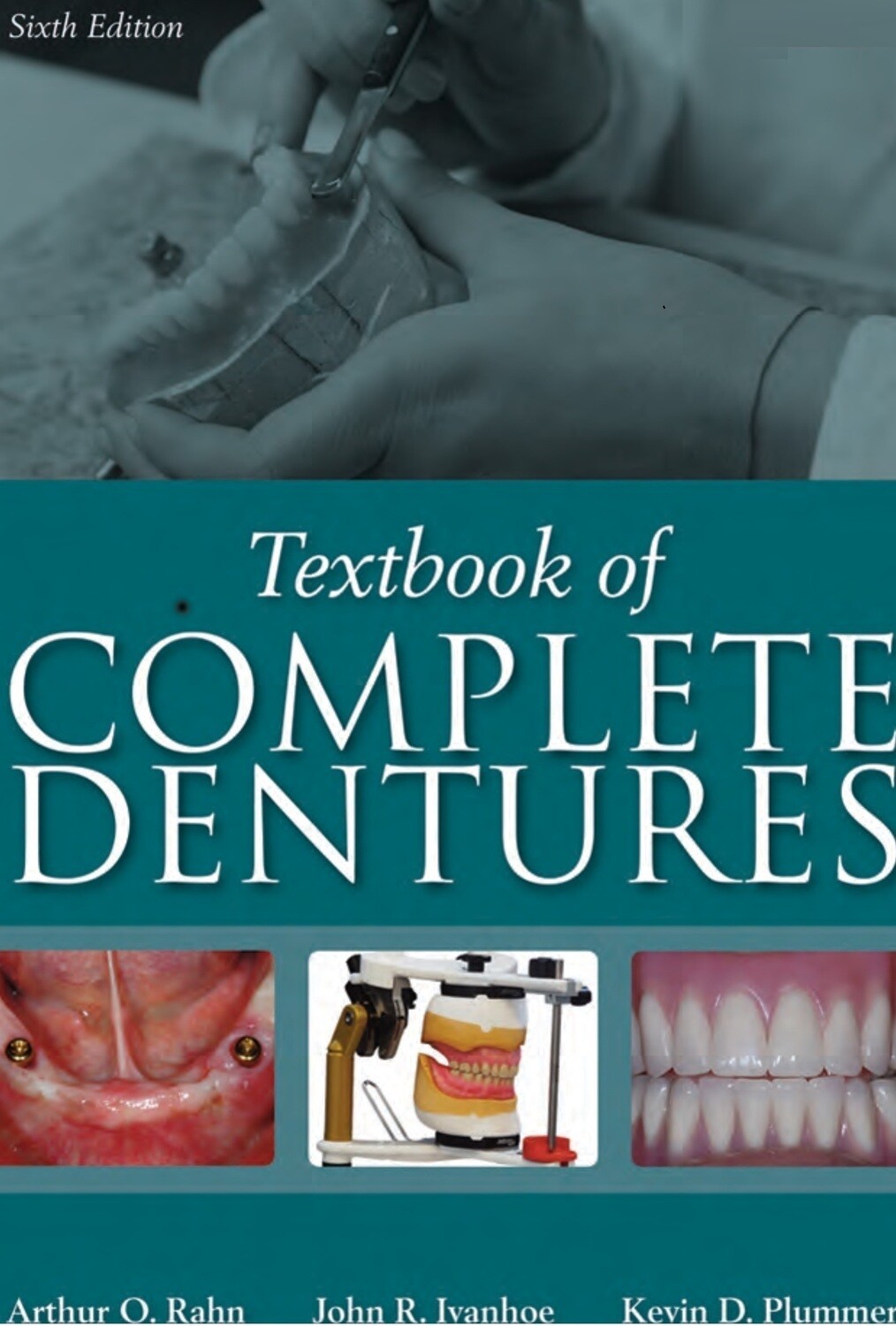 Textbook of Complete Dentures