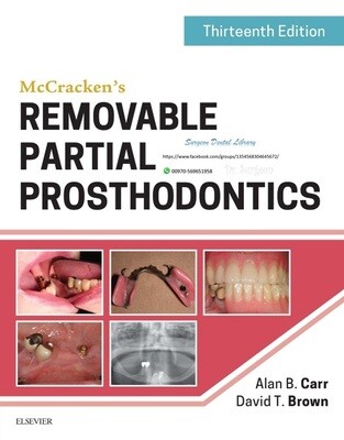 McCracken removable partial denture