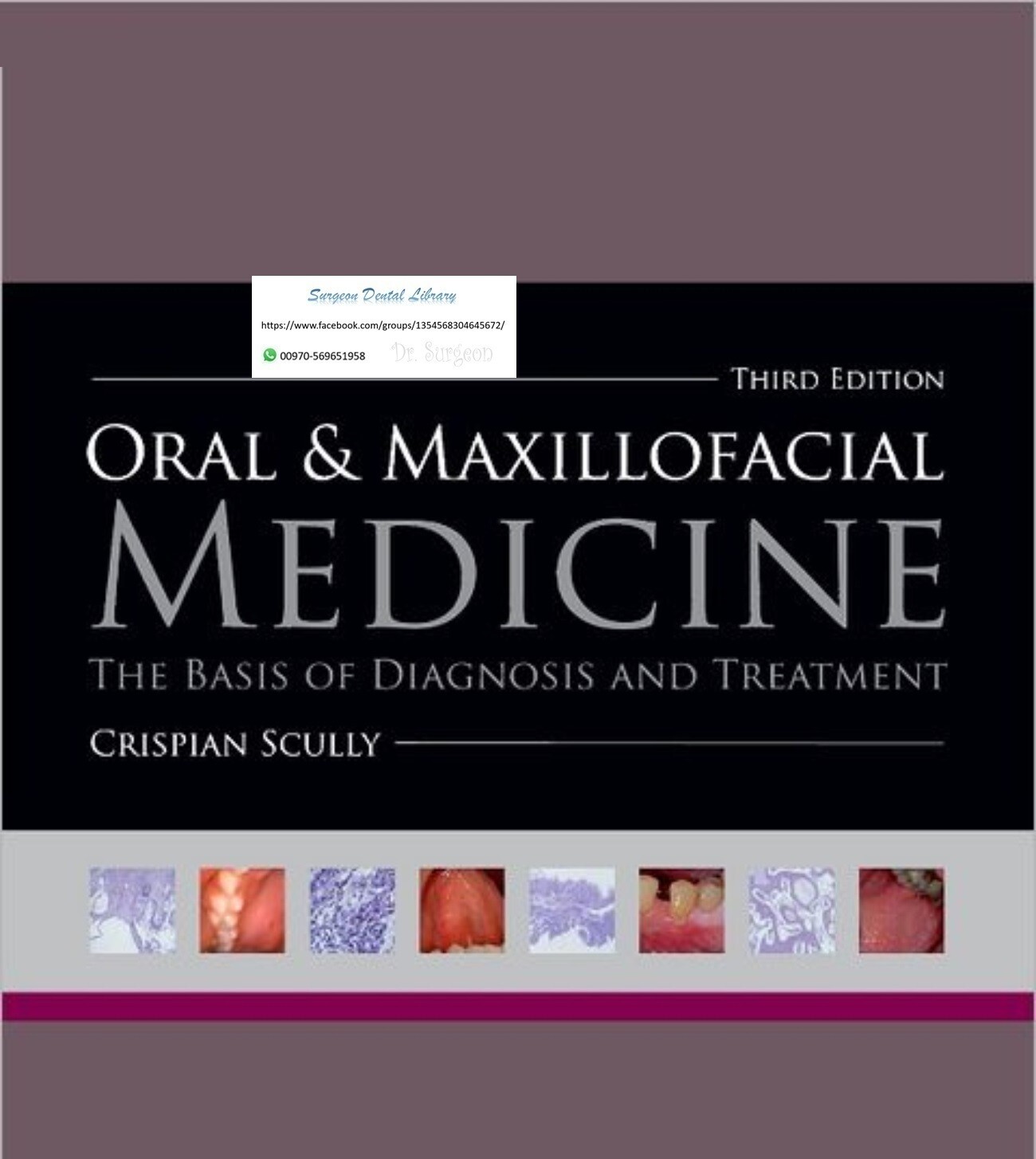 Oral and Maxillofacial Medicine scully
