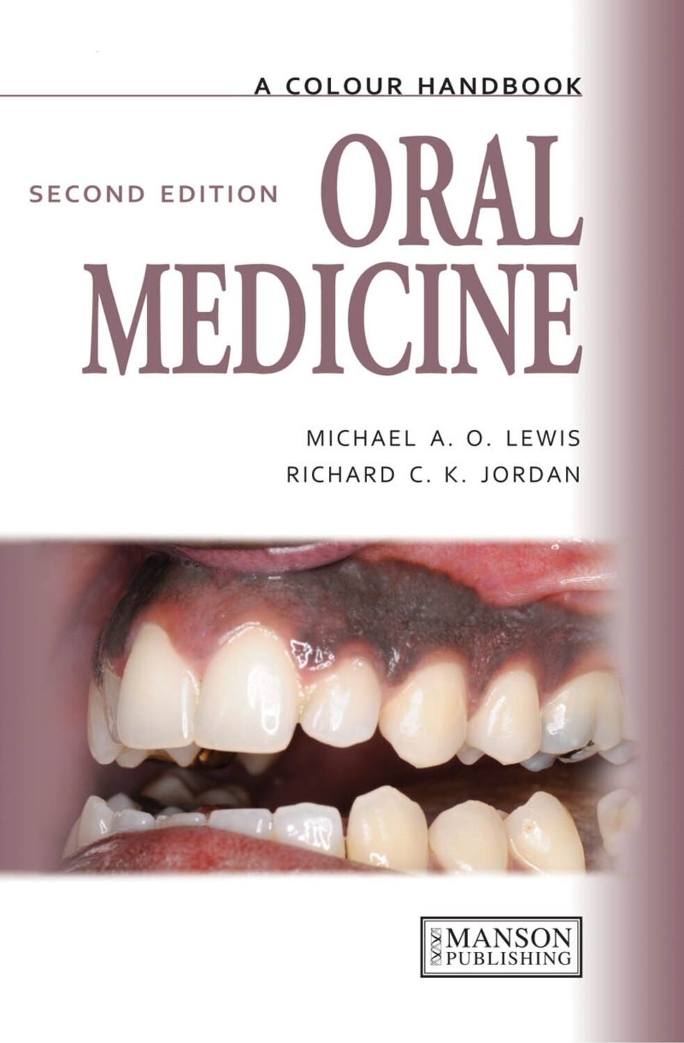 Oral Medicine A Color Handbook