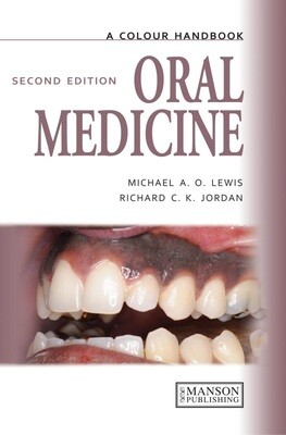 Oral Medicine A Color Handbook