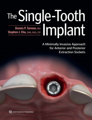 The Single-Tooth Implant A Minimally Invasive Approach for Anterior and Posterior Extraction Sockets