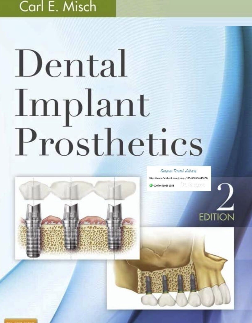 Dental implant prosthetics Carl misch